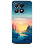 Чохол BoxFace Xiaomi 15T 