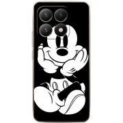 Чохол BoxFace Xiaomi 15T 