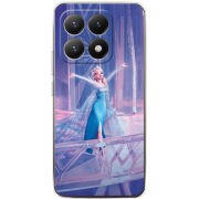 Чохол BoxFace Xiaomi 15T 