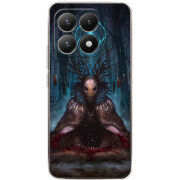 Чохол BoxFace Xiaomi 15T 