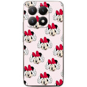 Чохол BoxFace Xiaomi 15T 