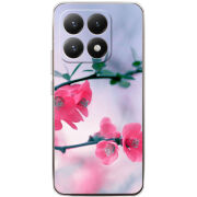 Чохол BoxFace Xiaomi 15T 