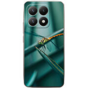 Чохол BoxFace Xiaomi 15T 