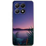 Чохол BoxFace Xiaomi 15T 