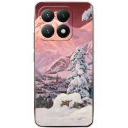 Чохол BoxFace Xiaomi 15T 