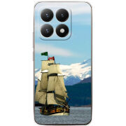 Чохол BoxFace Xiaomi 15T 