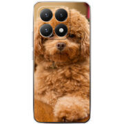 Чохол BoxFace Xiaomi 15T 