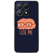 Чохол BoxFace Xiaomi 15T 