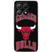 Чохол BoxFace Xiaomi 15T 