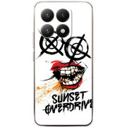 Чохол BoxFace Xiaomi 15T 