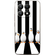 Чохол BoxFace Xiaomi 15T 