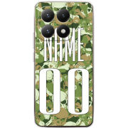 Чохол BoxFace Xiaomi 15T 