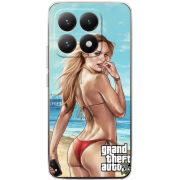 Чохол BoxFace Xiaomi 15T 