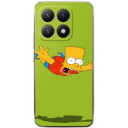 Чохол BoxFace Xiaomi 15T 