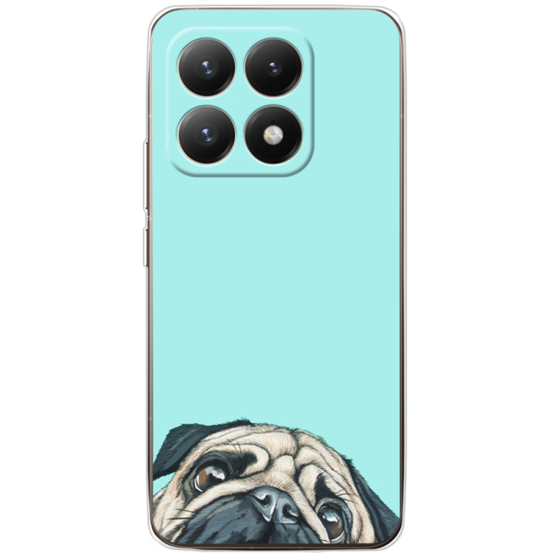 Чохол BoxFace Xiaomi 15T 