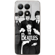 Чохол BoxFace Xiaomi 15T 