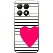 Чохол BoxFace Xiaomi 15T 