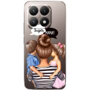 Прозорий чохол BoxFace Xiaomi 15T Super Mama