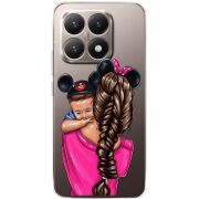 Прозорий чохол BoxFace Xiaomi 15T Mouse Mommy