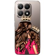 Прозорий чохол BoxFace Xiaomi 15T Queen and Princess