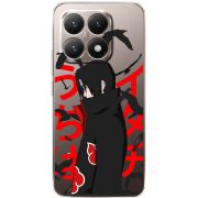 Прозорий чохол BoxFace Xiaomi 15T Учиха Итачи