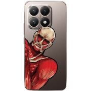 Прозорий чохол BoxFace Xiaomi 15T Титан