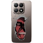 Прозорий чохол BoxFace Xiaomi 15T Нападение Титана