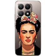 Прозорий чохол BoxFace Xiaomi 15T Фрида Кало