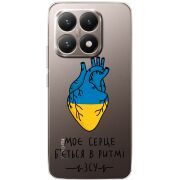 Прозорий чохол BoxFace Xiaomi 15T Моє серце в ритмі ЗСУ