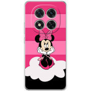 Чохол BoxFace Xiaomi Redmi Note 15 Pro Plus 