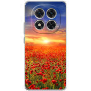 Чохол BoxFace Xiaomi Redmi Note 15 Pro Plus 