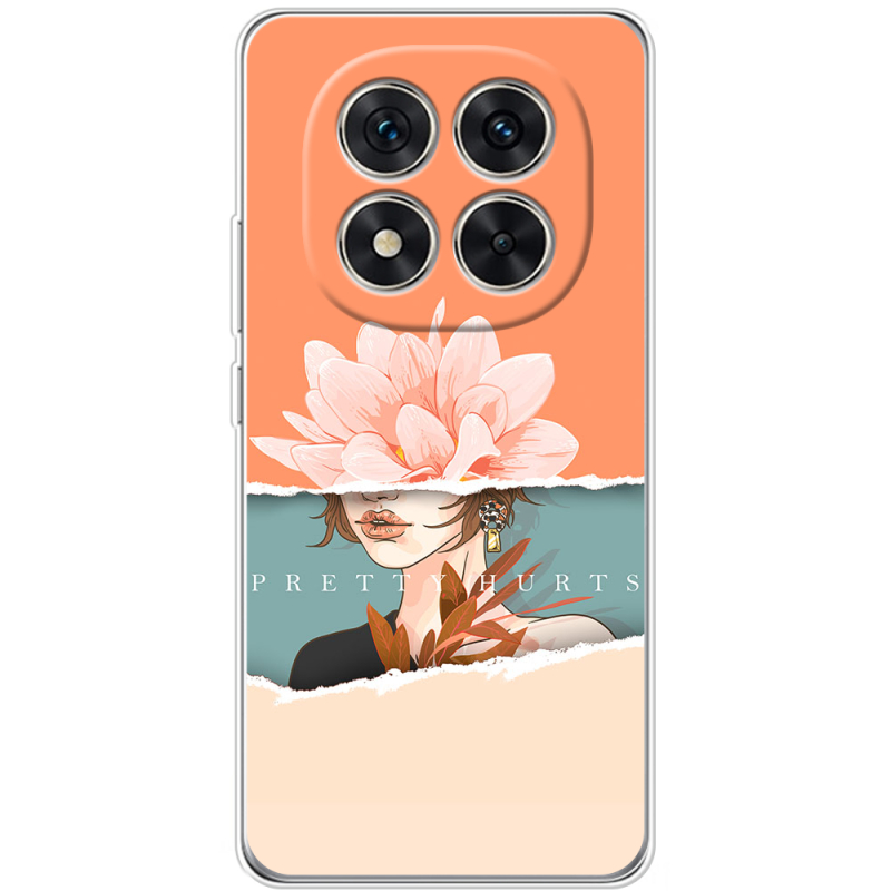 Чохол BoxFace Xiaomi Redmi Note 15 Pro Plus 