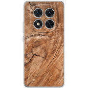 Чохол BoxFace Xiaomi Redmi Note 15 Pro Plus 