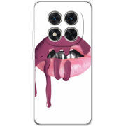 Чохол BoxFace Xiaomi Redmi Note 15 Pro Plus 