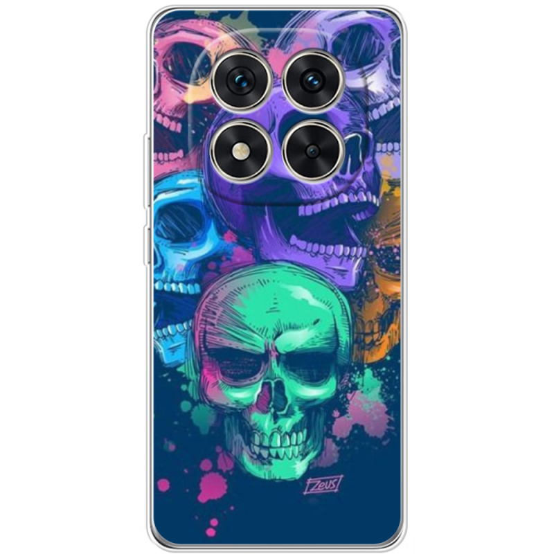 Чохол BoxFace Xiaomi Redmi Note 15 Pro Plus 