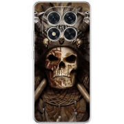 Чохол BoxFace Xiaomi Redmi Note 15 Pro Plus 