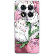 Чохол BoxFace Xiaomi Redmi Note 15 Pro Plus 