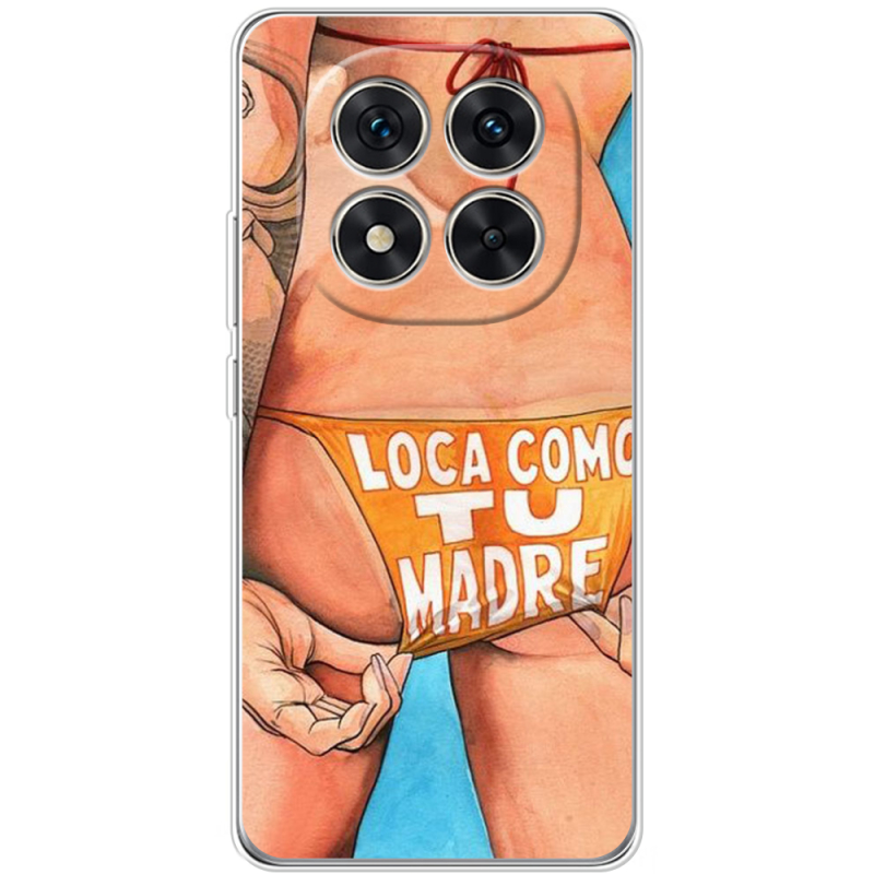 Чохол BoxFace Xiaomi Redmi Note 15 Pro Plus 