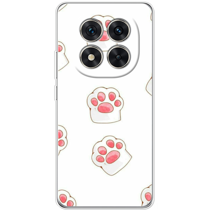 Чохол BoxFace Xiaomi Redmi Note 15 Pro Plus 