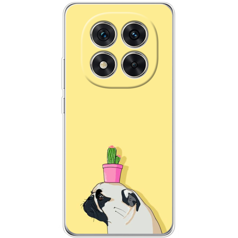 Чохол BoxFace Xiaomi Redmi Note 15 Pro Plus 