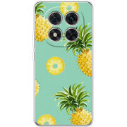 Чохол BoxFace Xiaomi Redmi Note 15 Pro Plus 