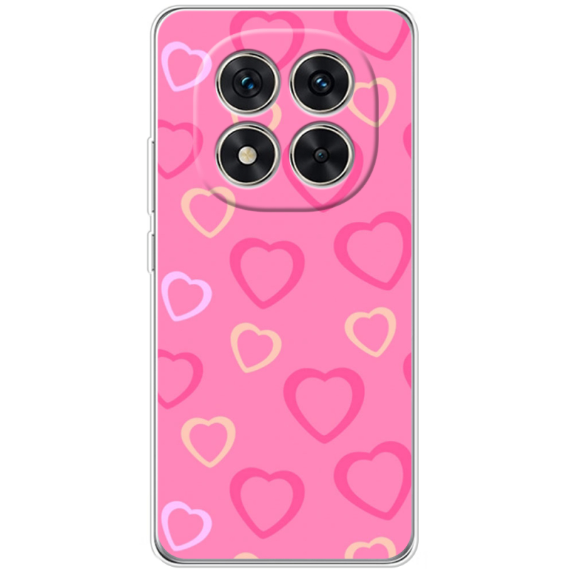 Чохол BoxFace Xiaomi Redmi Note 15 Pro Plus Sugar Hearts