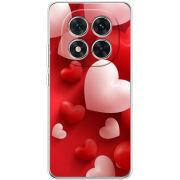 Чохол BoxFace Xiaomi Redmi Note 15 Pro Plus 