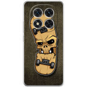 Чохол BoxFace Xiaomi Redmi Note 15 Pro Plus 