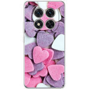 Чохол BoxFace Xiaomi Redmi Note 15 Pro Plus Сердечки