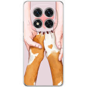 Чохол BoxFace Xiaomi Redmi Note 15 Pro Plus 