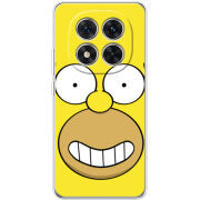 Чохол BoxFace Xiaomi Redmi Note 15 Pro Plus 