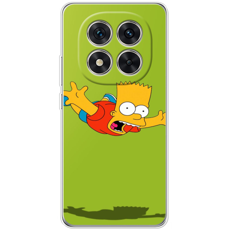 Чохол BoxFace Xiaomi Redmi Note 15 Pro Plus 