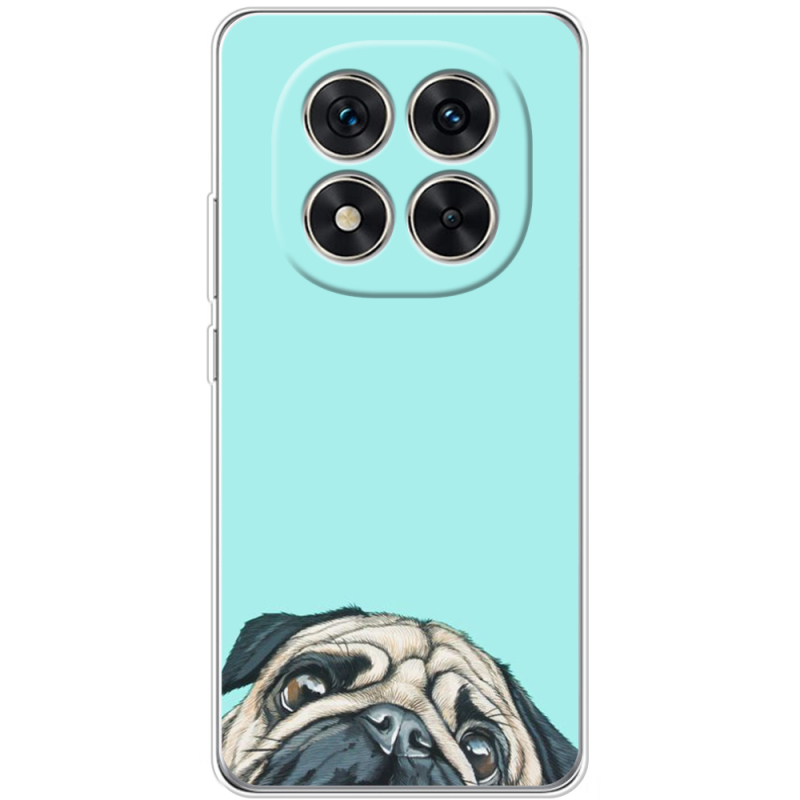 Чохол BoxFace Xiaomi Redmi Note 15 Pro Plus 