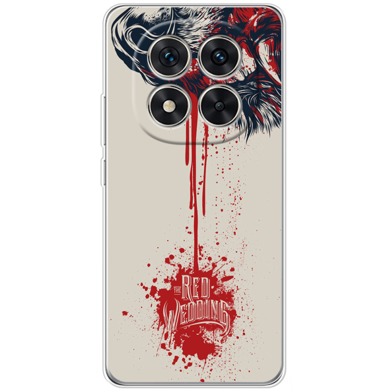 Чохол BoxFace Xiaomi Redmi Note 15 Pro Plus 